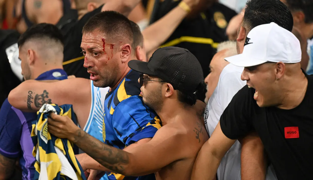 Seorang suporter Argentina terluka saat kericuhan sebelum laga Kualifikasi Piala Dunia 2026 antara Brasil melawan Argentina di Stadion Maracana, Brasil, Rabu (22/11/2023) WIB. (AFP/Carl De Souza)