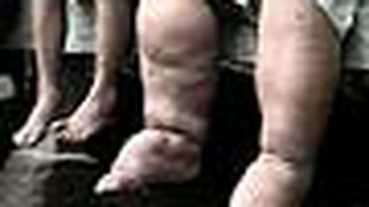 t091119ckesehatan_kakigajah.jp
