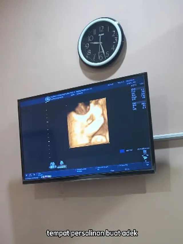 Nadya Mustika Hamil Anak Kedua