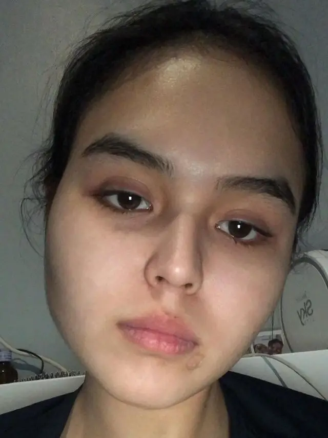 7 Potret Terbaru Selebgram Laura Anna, Mantan Kekasih Gaga Muhammad yang Viral