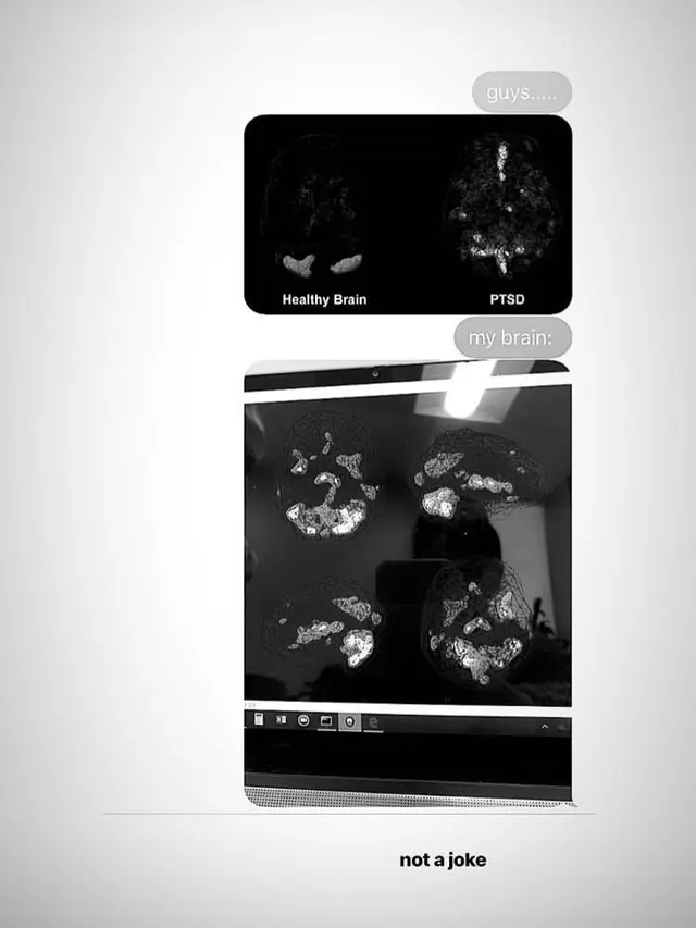 Hasil pemindaian otak Ariana Grande