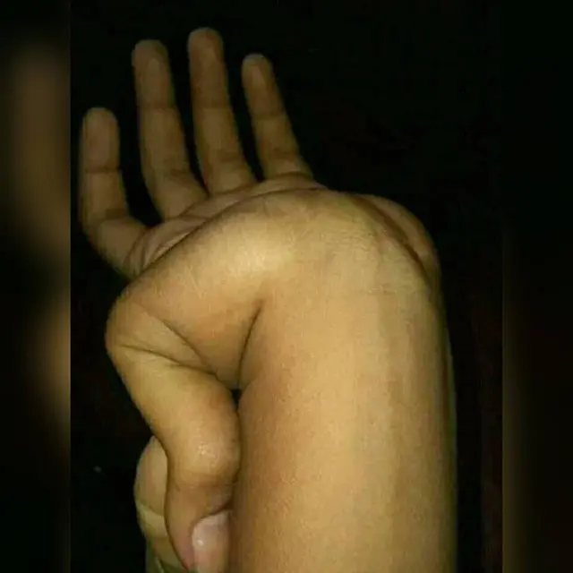 6 Aksi Nyeleneh Orang Kalau Punya Tangan Lentur Ini Bikin Heran
