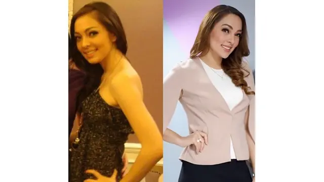 5 Foto Lawas Dokter Reisa Broto Asmoro, Bukti Cantik Sedari Dulu