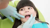 6 Dampak Karies pada Anak, Tak Cuma Bikin Sakit Gigi