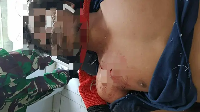 La Randi, mahasiswa UHO yang ditembak saat berusaha diselamatkan rekan-rekannya.(Liputan6.com/Ahmad Akbar Fua)