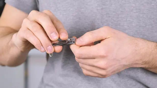 Cara Menghilangkan Kebiasaan Buruk Menggigit Kuku