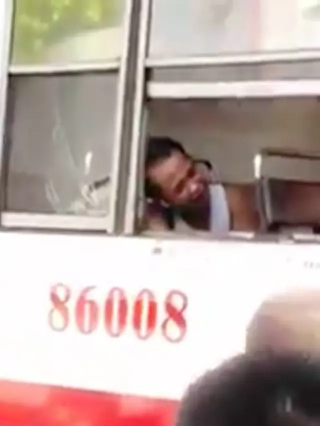 pria kehilangan tangan saat tidur di bus (foto: Facebook The Philippines News)