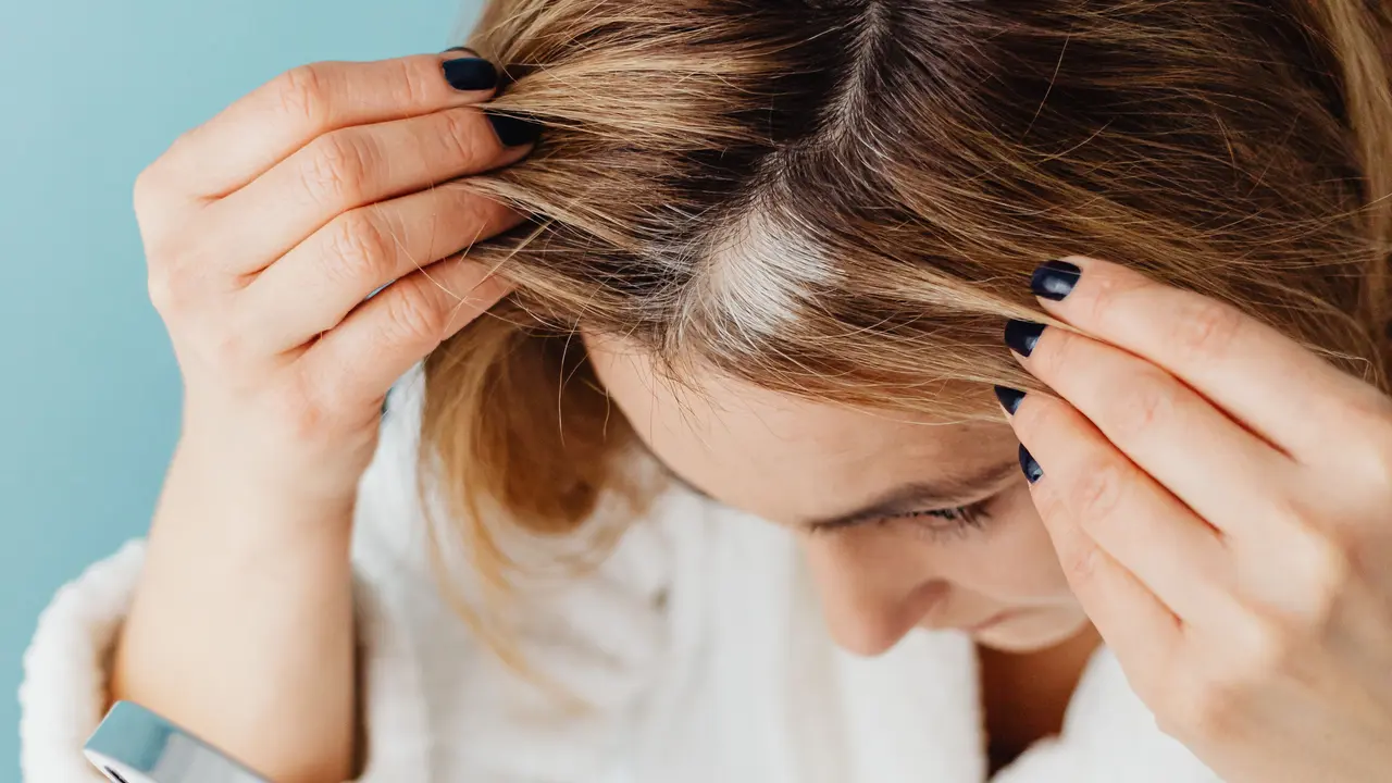 Tips Merawat Rambut Berketombe agar Tetap Sehat dan Lembap