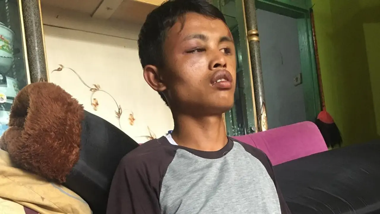 Alimudin, anggota Barisan Ansor Serbaguna (Banser) Majelis Wakil Cabang (MWC) Nahdlatul Ulama (NU) Kecamatan Karangpawitan, Garut, Jawa Barat, diserang sekelompok orang di Kerkof Garut. (Liputan6.com/Jayadi Supriadin)