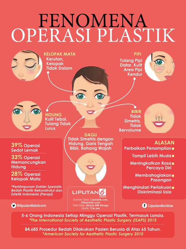 Infografis Fenomena Operasi Plastik (Liputan6.com/Triyasni)