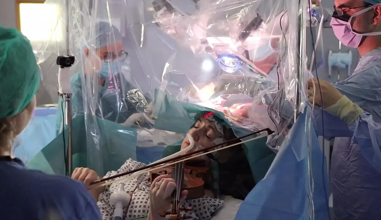 Musisi Dagmar Turner bermain biola saat operasi pengangkatan tumor otak di King's College Hospital, London, 31 Januari 2020. Turner terus memainkan biola saat pengangkatan tumor dari lobus frontal bagian kanan, dekat dengan bagian yang mengontrol gerakan tangan kirinya (KING'S COLLEGE HOSPITAL/AFP)