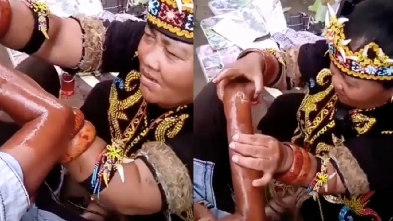 Viral Terapi Patah Tulang Pakai Minyak Bintang Dayak, Jadi Sorotan Warganet