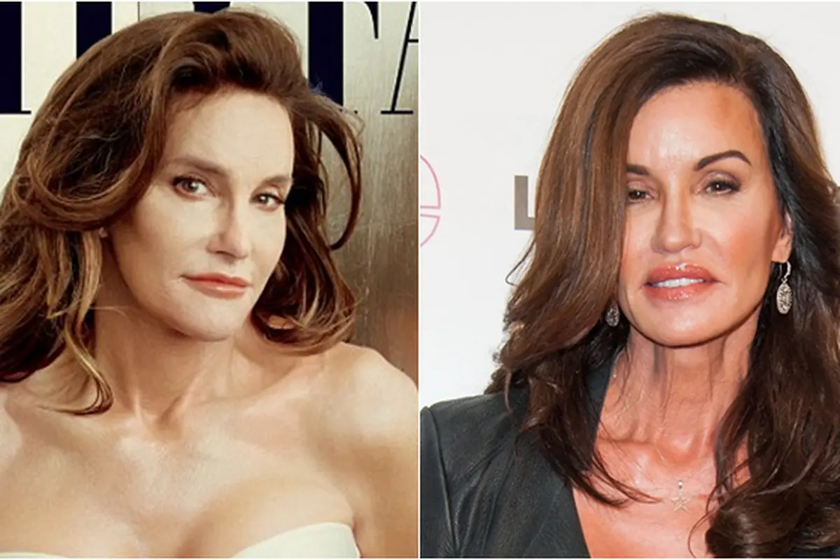 Bruce Jenner a.k.a Caitlyn Jenner vs Janice Dickinson