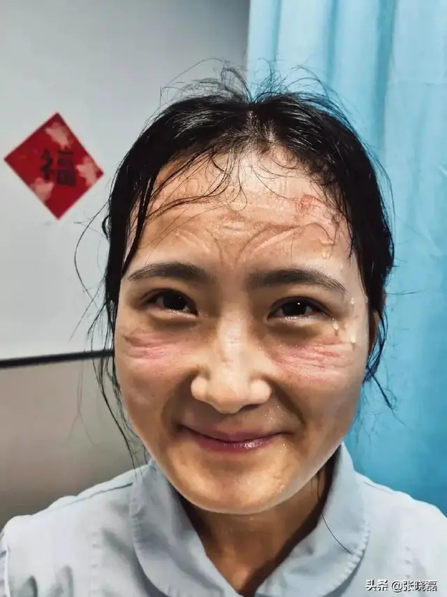 6 Potret Wajah Suster Rawat Pasien Virus Corona Ini Bikin Haru