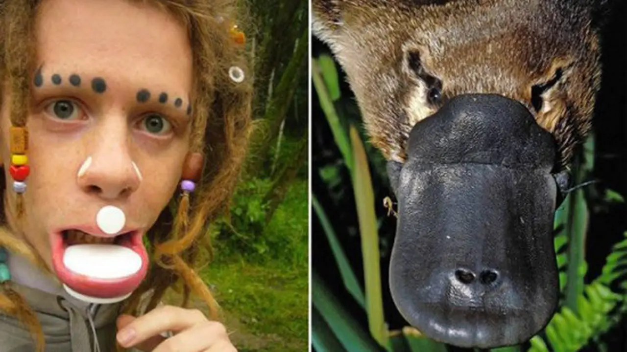 Wajah mirip platipus. (Daily Mail)