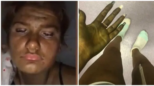 Wanita Ini 'Berubah' Jadi Putri Fiona di Film Shrek Usai Gunakan Krim Tanning