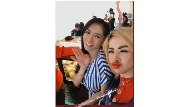 Barbie mengaku setelah sulam, bibirnya sempat mengalami bengkak.