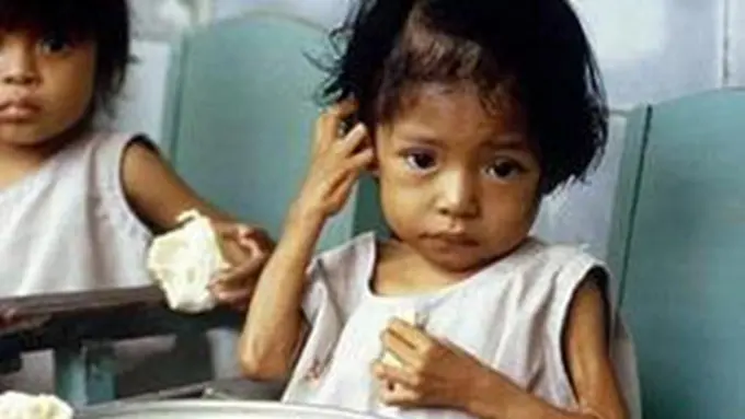 Waspada Gizi Buruk! Kenali Tanda-Tandanya