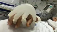 Sarung tangan hangat untuk memberi kenyamanan pasien Covid-19 yang berada di ICU (Sumber: Facebook/Messaggero.it)