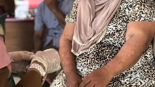 Penanganan kusta di Indramayu