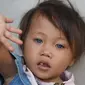 Amelia Anggraeni (2,5) memiliki wafna bola mata yang berubah-ubah. (Liputan6.com/Huyogo Simbolon)