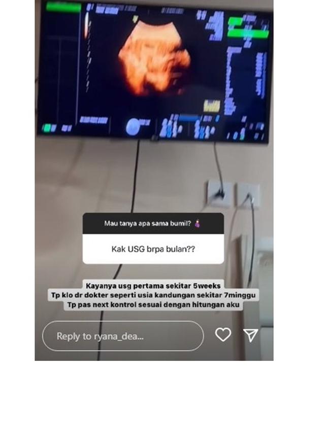 6 Potret Ryana Dea Umumkan Kehamilan Ketiga, Sudah Pamer Baby Bump