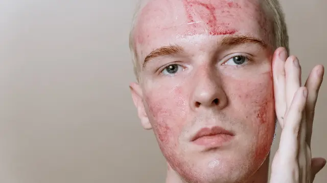 ilustrasi skincare pria cowok