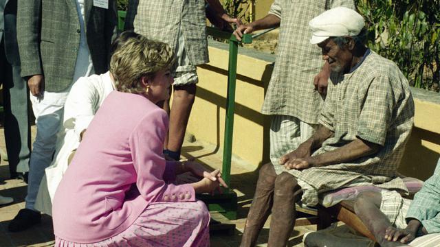 Putri Diana dengan pasien kusta di Rumah Sakit Anandaban di Kathmandu Selatan pada 4 Maret 1993. Foto ini diambil di hari kelima saat Diana mengunjungi Nepal (AP)