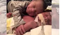 Kisah Haru, Perpisahan Bayi Kepada Saudara Kembarnya