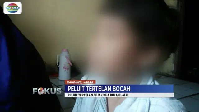 Peluit Diangkat dari Paru-Paru, Kondisi Bocah di Bandung Membaik