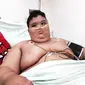 Kondisi Rizki Rahmat Ramadhan (10), bocah obesitas asal Palembang, berangsur membaik. (Liputan6.com/Nefri Inge)