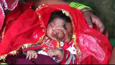 Seorang bayi asal India terlahir dengan hidung yang tampak seperti belalai gajah.Bayi ini dipercayai oleh masyarakat India sebagai reinkarnasi dari dewa Ganesha