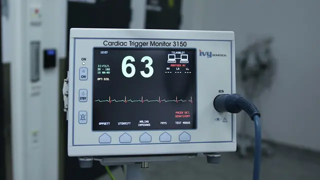 Ilustrasi EKG.