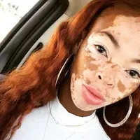 Setiap orang memiliki keunikannya masing-masing dan hal itu bukanlah sesuatu yang salah. Belajarlah dari 10 wanita ini. (Foto: Instagram/tru_origin)