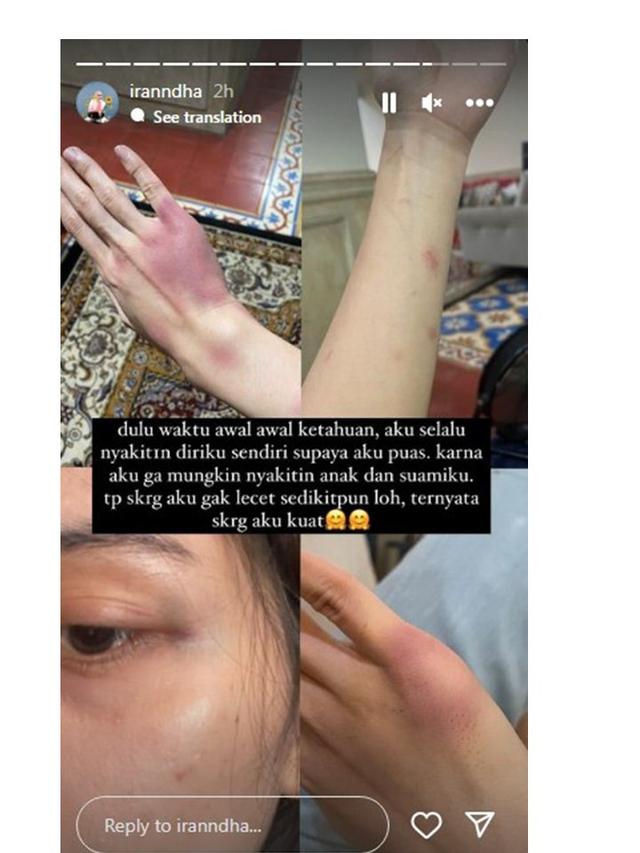 10 Potret Ira Nandha, Seleb TikTok yang Ungkap Dugaan Suami Selingkuh dengan Pramugari