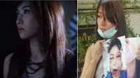 Ingin Cantik, Wajah Model Ini Malah Hancur 