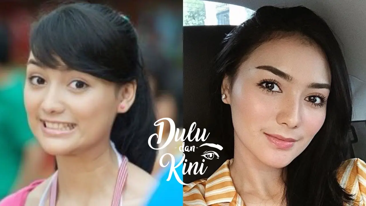 Dulu dan Kini: Caantiknya Tidak Berubah, Berikut Transformasi Citra Kirana