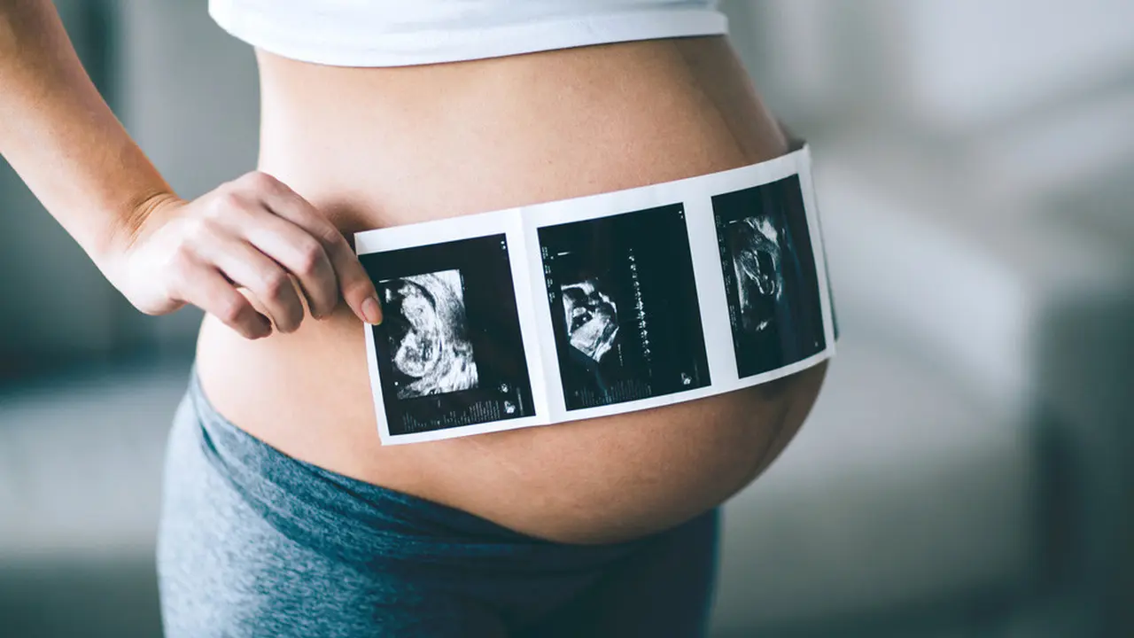 Ilustrasi USG Fetomaternal dengan Teknologi AI (Nd3000/Shutterstock)