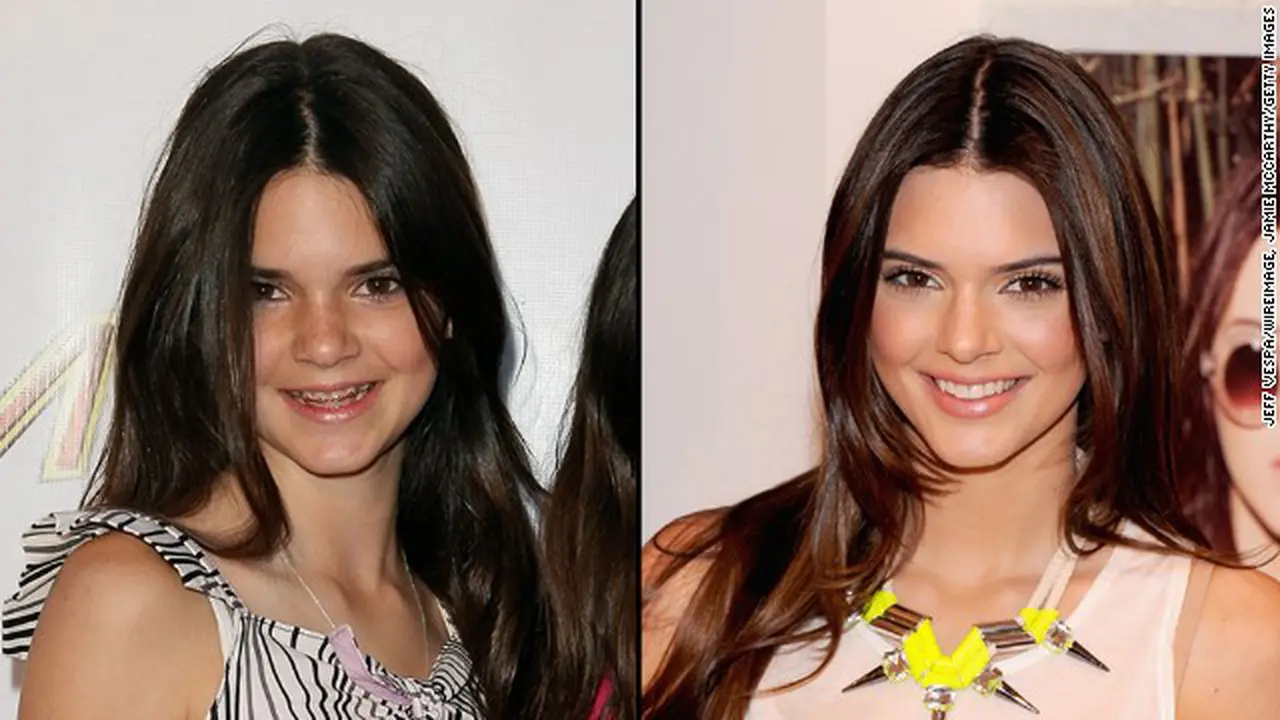 Metamorfosa Kendall Jenner dari Waktu ke Waktu