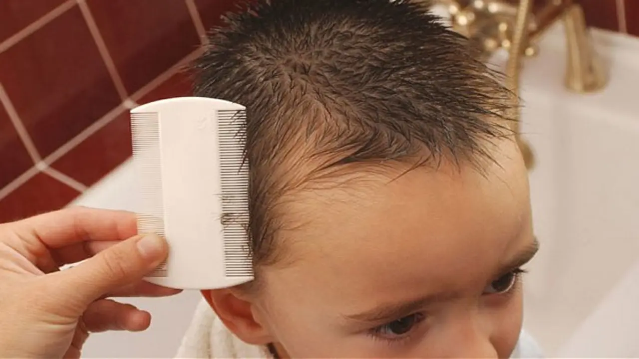 Kutu Rambut