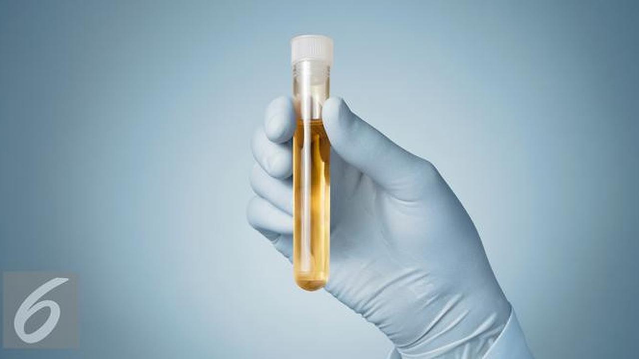 Ilustrasi Foto Air Seni atau Urine