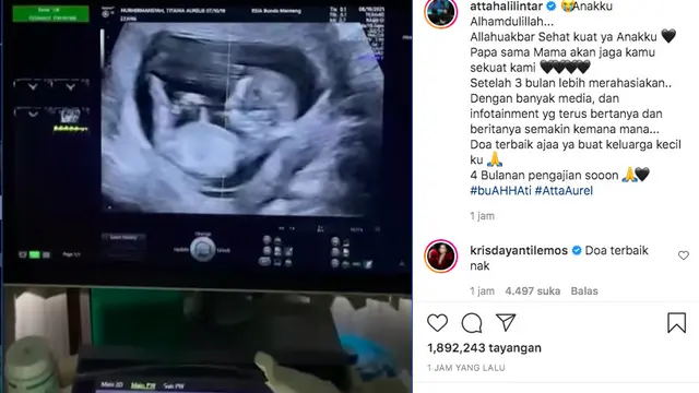 Atta Halilntar Umumkan Kehamilan Aurel Hermansyah, Usia Kandungan Menuju 4 Bulan (instagram.com/attahalilintar)