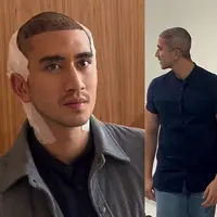 Verrell Bramasta tanam rambut (Instagram/bramastavrl)