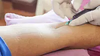 Pentingnya Tes A1C  untuk Diabetesi