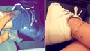 Alasan pertama adalah Travis Scott dan Kylie Jenner miliki tato sama dengan gambar kupu-kupu. (Rap-Up)