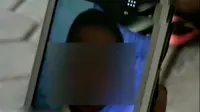 Murid SD Alami Kebutaan Setelah Dianiaya Kakak Kelas