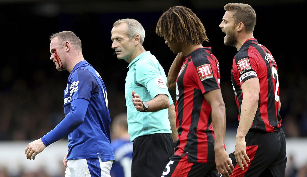 Striker Everton, Wayne Rooney, meninggalkan lapangan usai mengalami pendarahan di mata kirinya pada Premier League, di Stadion Goodison Park, Sabtu (23/9/2017). Everton menang 2-1 atas Bournemouth. (AP/Barrington Coombs)