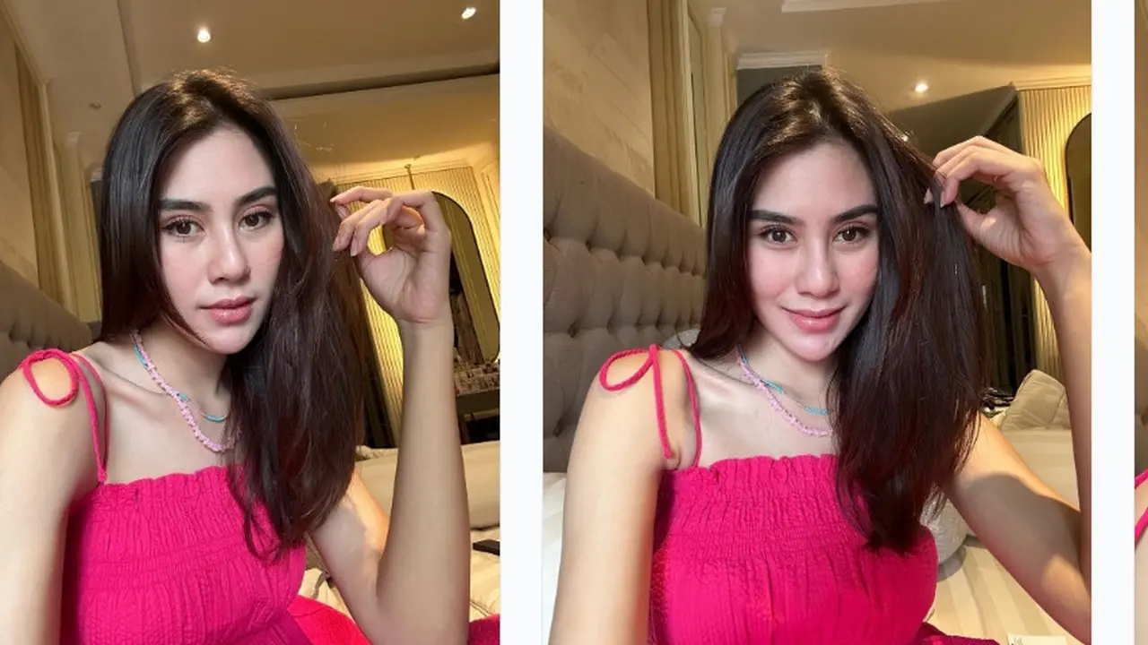 Potret Syahnaz Sadiqah terbaru dituding operasi plastik (Foto: Instagram syahnazs)