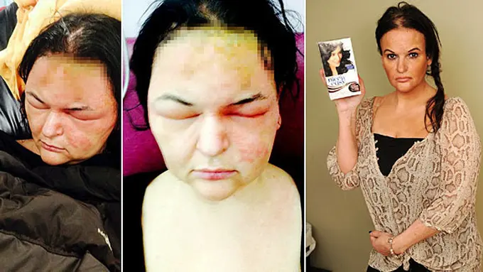 Foto: copyright dailymail.co.uk