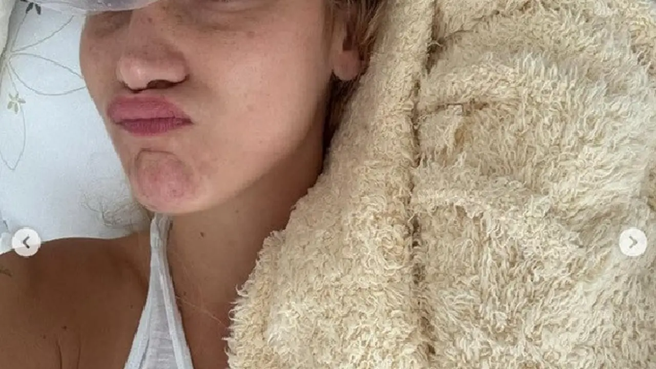 Bella Hadid Unggah Foto Lengan Diinfus, Kembali Diserang Lyme Disease?